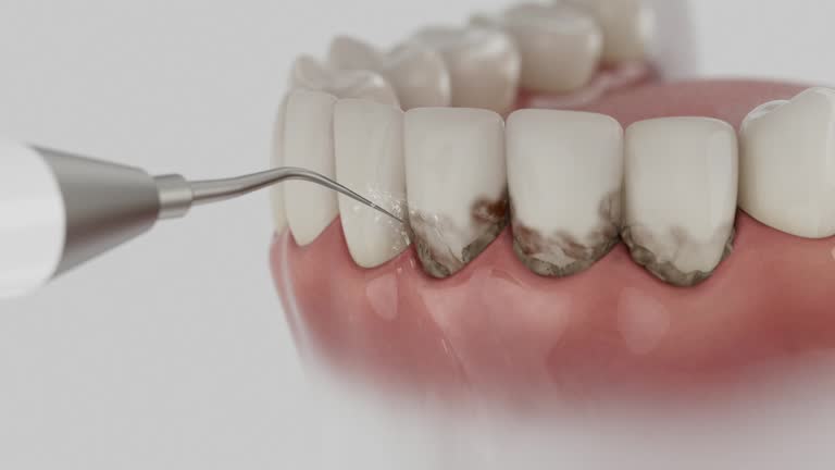 Reliable Dental contractor in Olivia, MN by Dentist Open Now